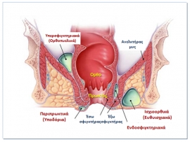 Περιπρωκτικό απόστημα και συρίγγιο