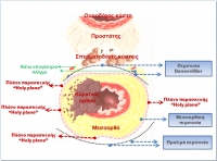 Η μεσοσφιγκτηριακή εκτομή για τον καρκίνο του κατώτερου ορθού